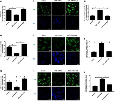 The Increased Endogenous Sulfur Dioxide Acts as a Compensatory Mechanism for the Downregulated Endogenous Hydrogen Sulfide Pathway in the Endothelial Cell Inflammation